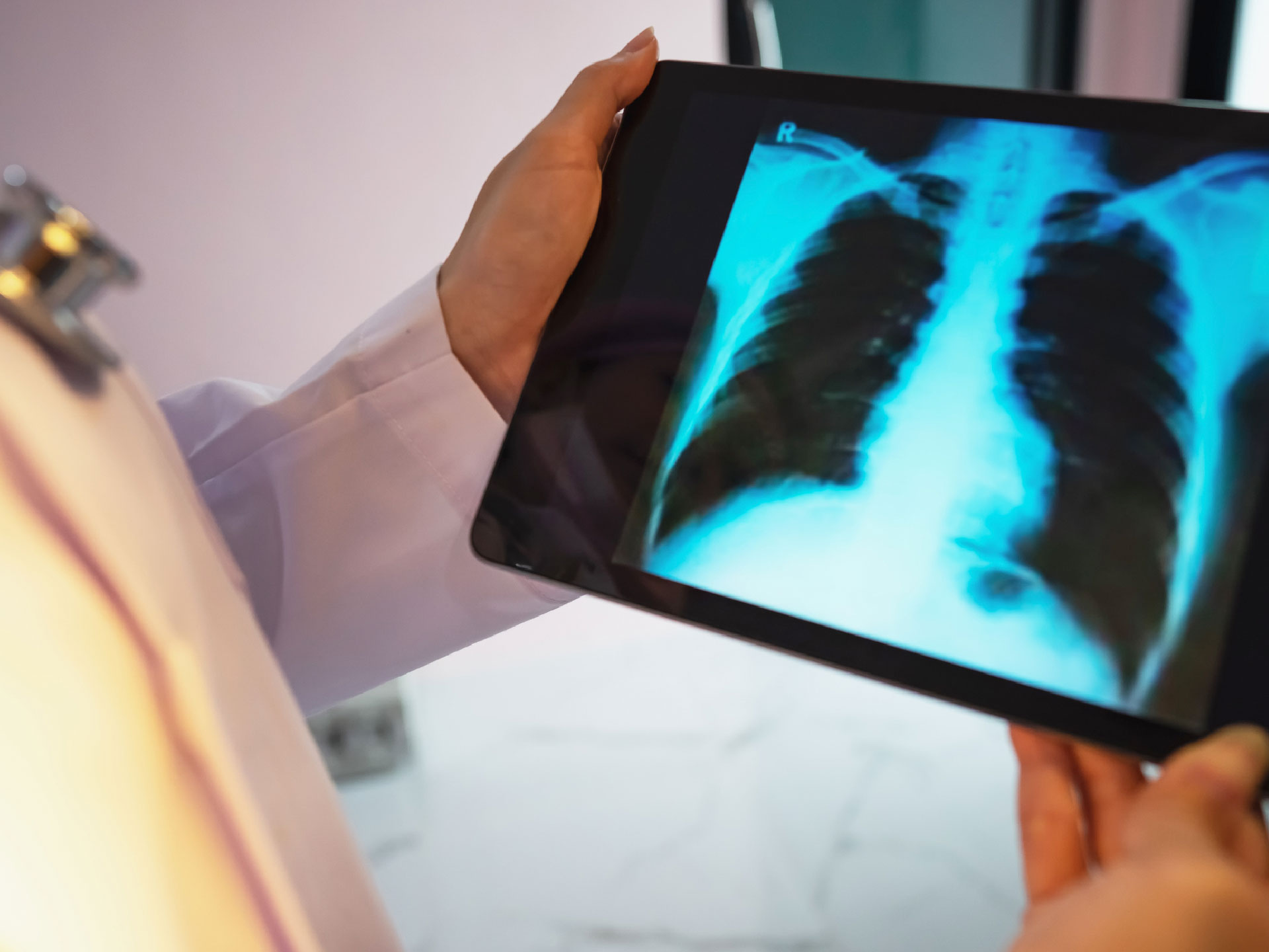 Content Footer COPD Röntgenbild